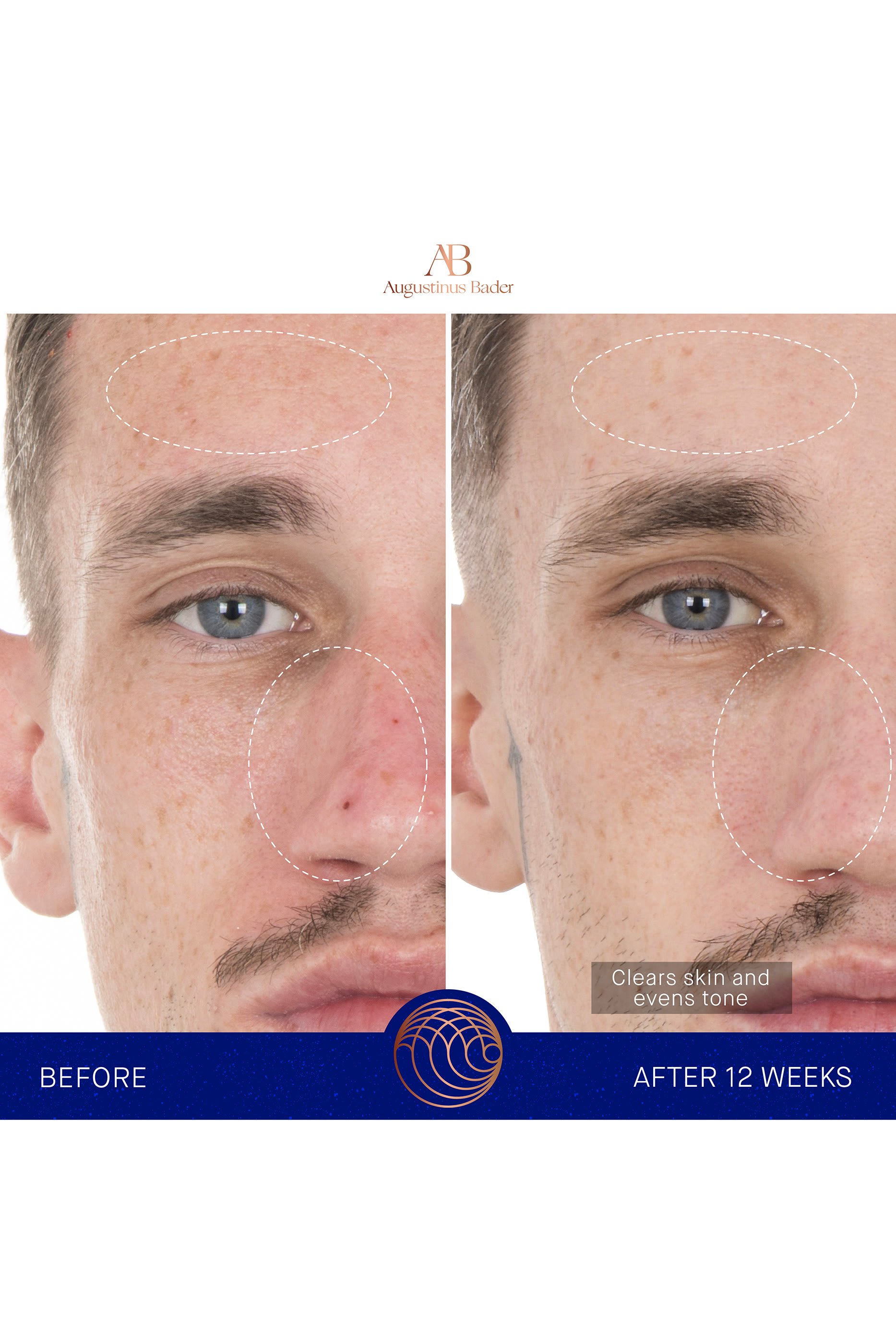 سيروم ريتينول 