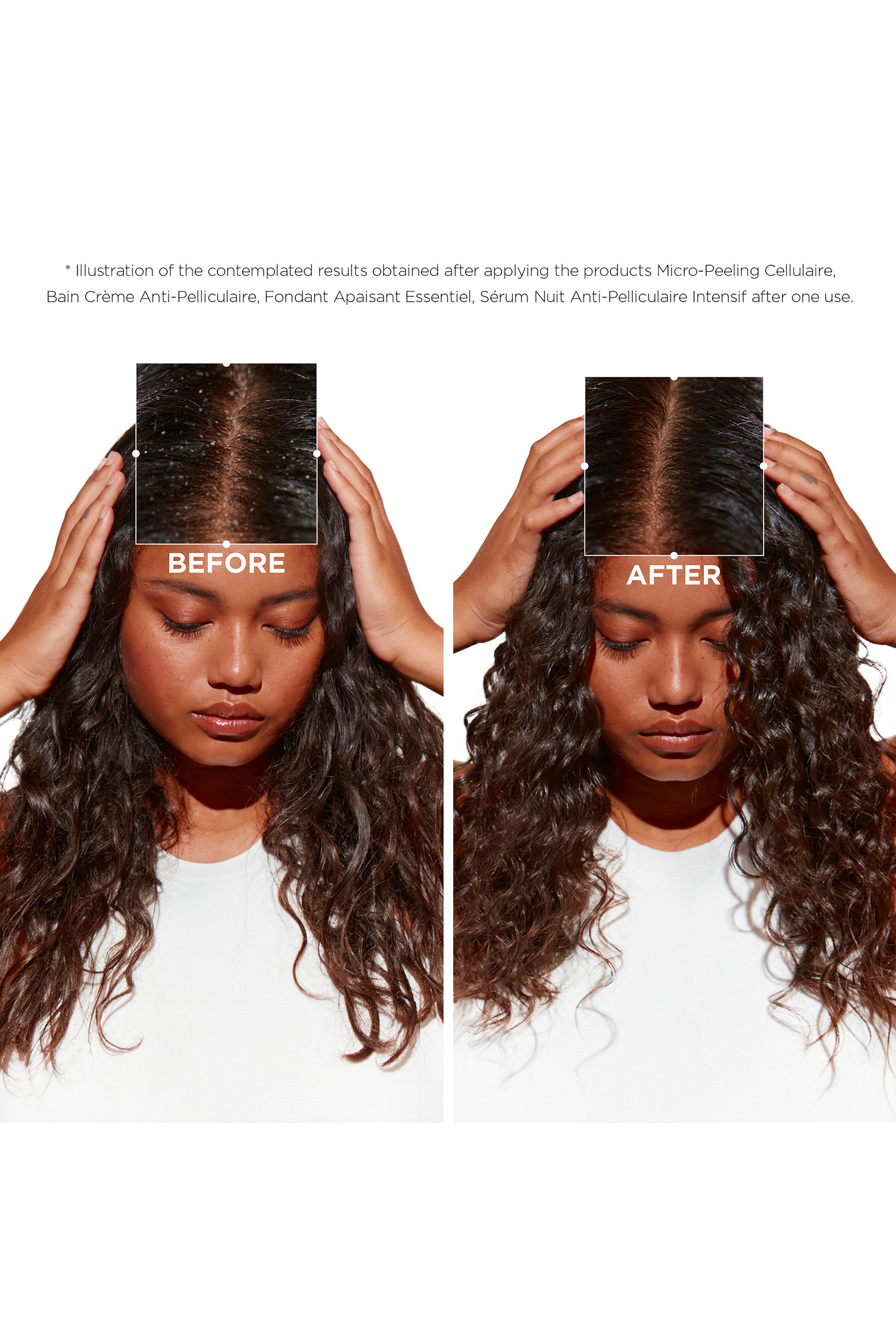 شامبو سيمبيوس مرطب ومضاد للقشرة