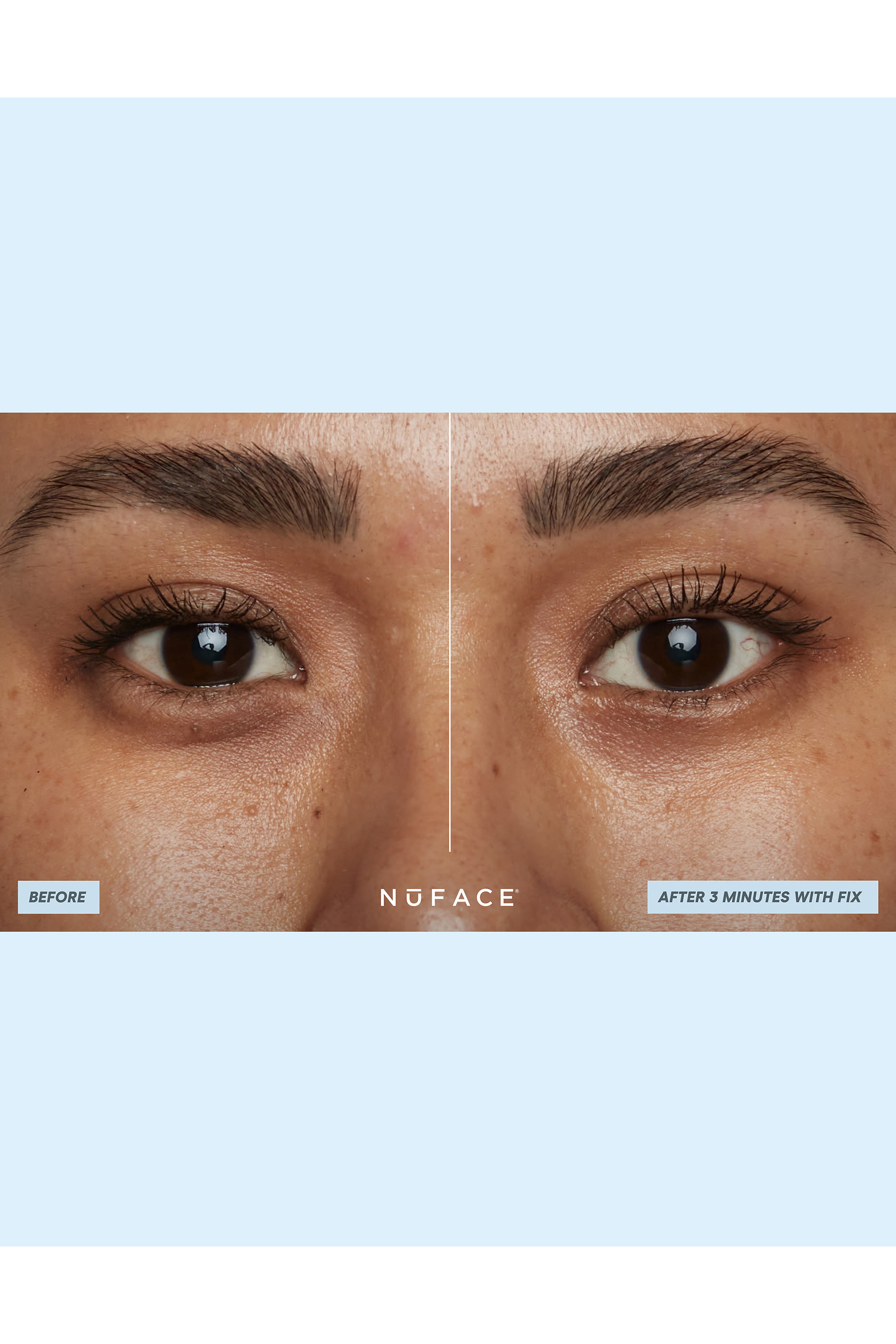 لصقات ايون بليكس بقوام جل مائي لتنشيط البشرة