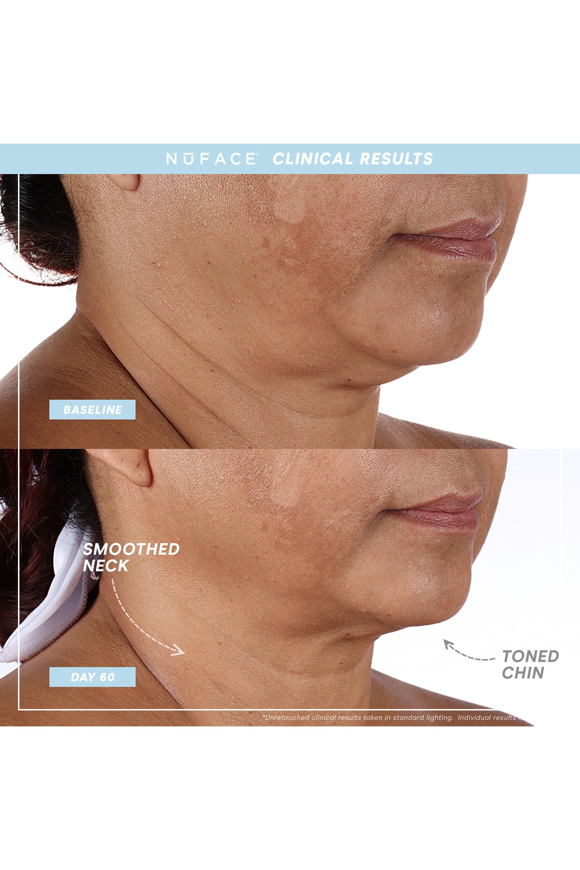 مجموعة العناية الأساسية وجهاز نوفيس ترينيتي بلس برو